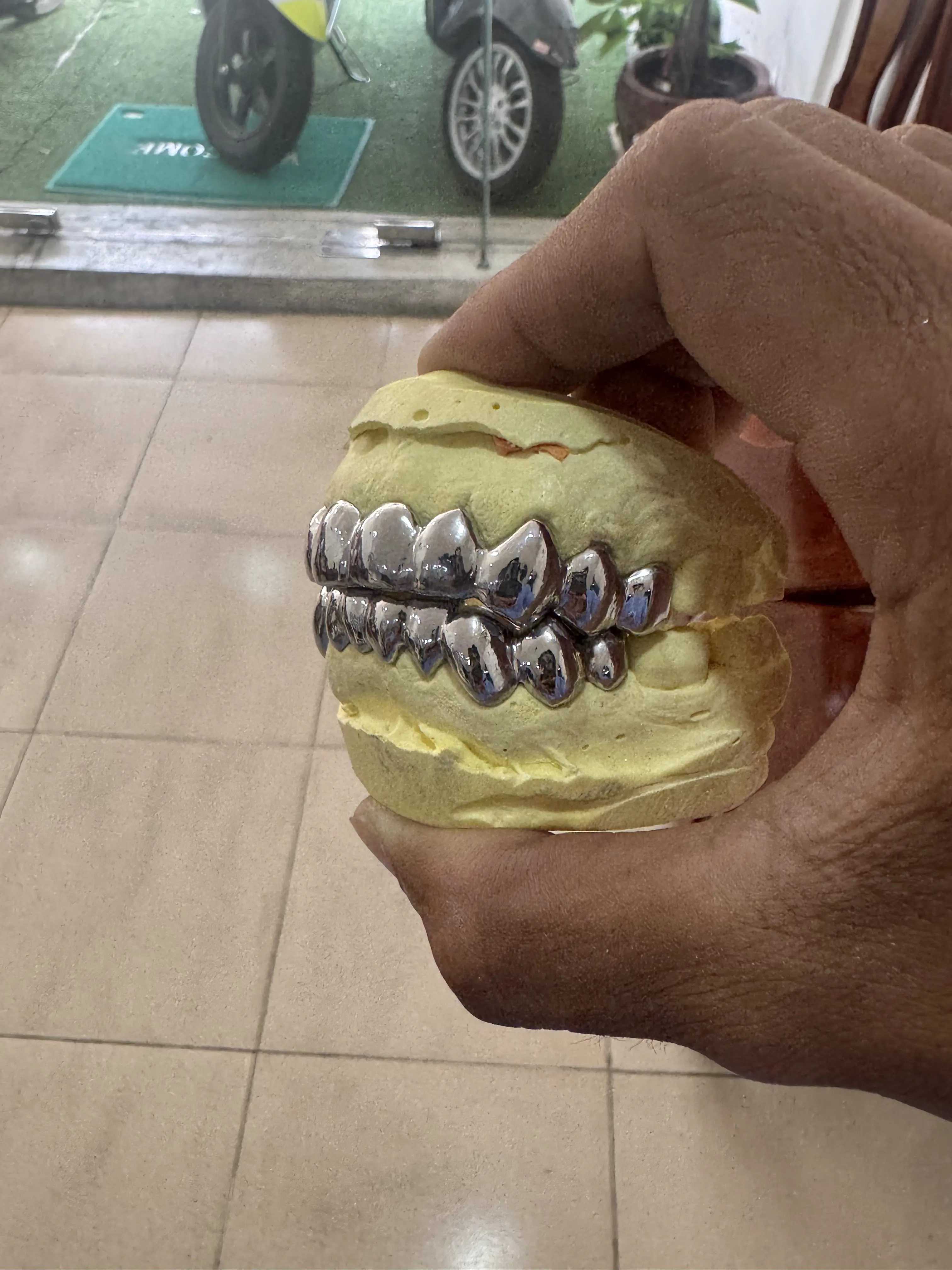 Close up of Full Ceramic silver Grillz 10 on 10 Dental Jewelry