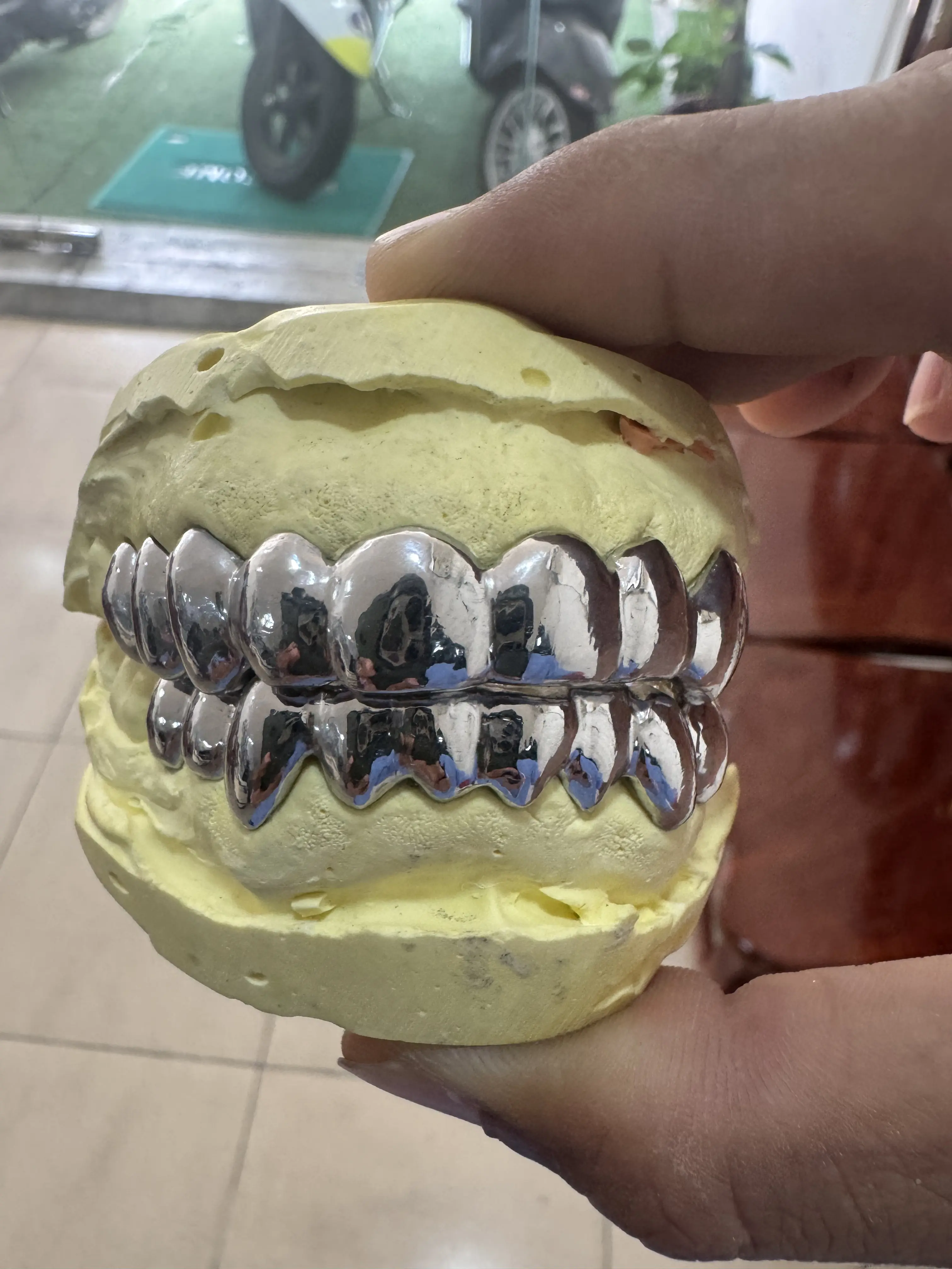 Full Ceramic silver Grillz 10 on 10 Custom in Phnom Penh Cambodia