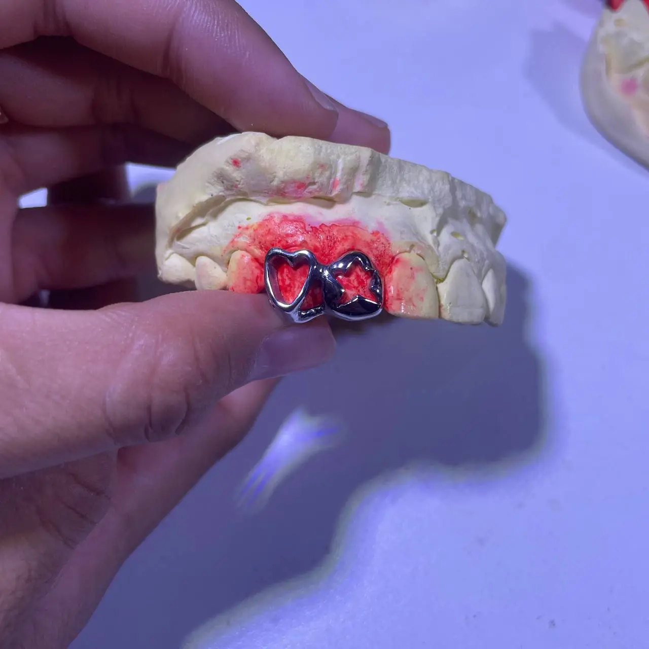 Heart and star grillz in Phnom Penh Cambodia