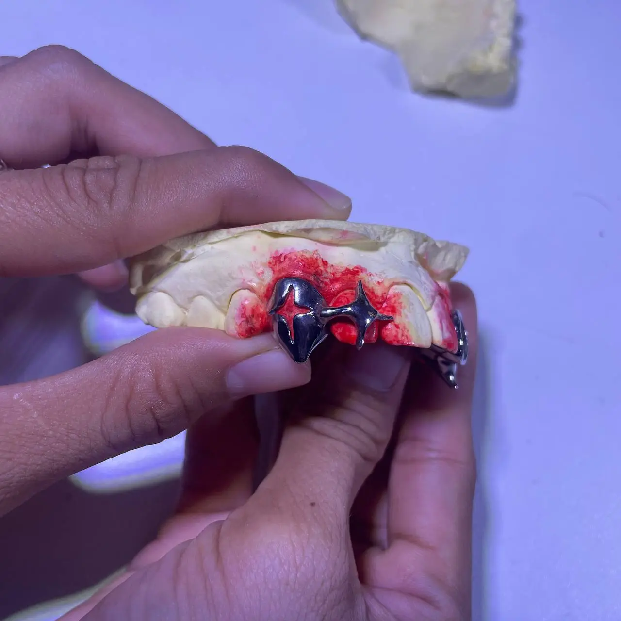 Custom star cut plus star grillz in Phnom Penh Cambodia