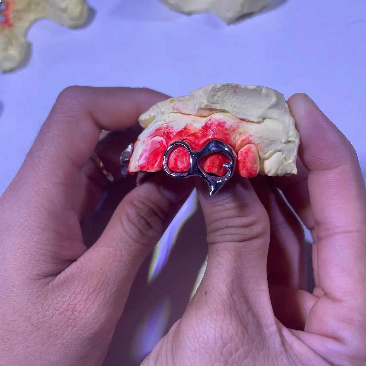 Window and heart cut grillz in Phnom Penh Cambodia