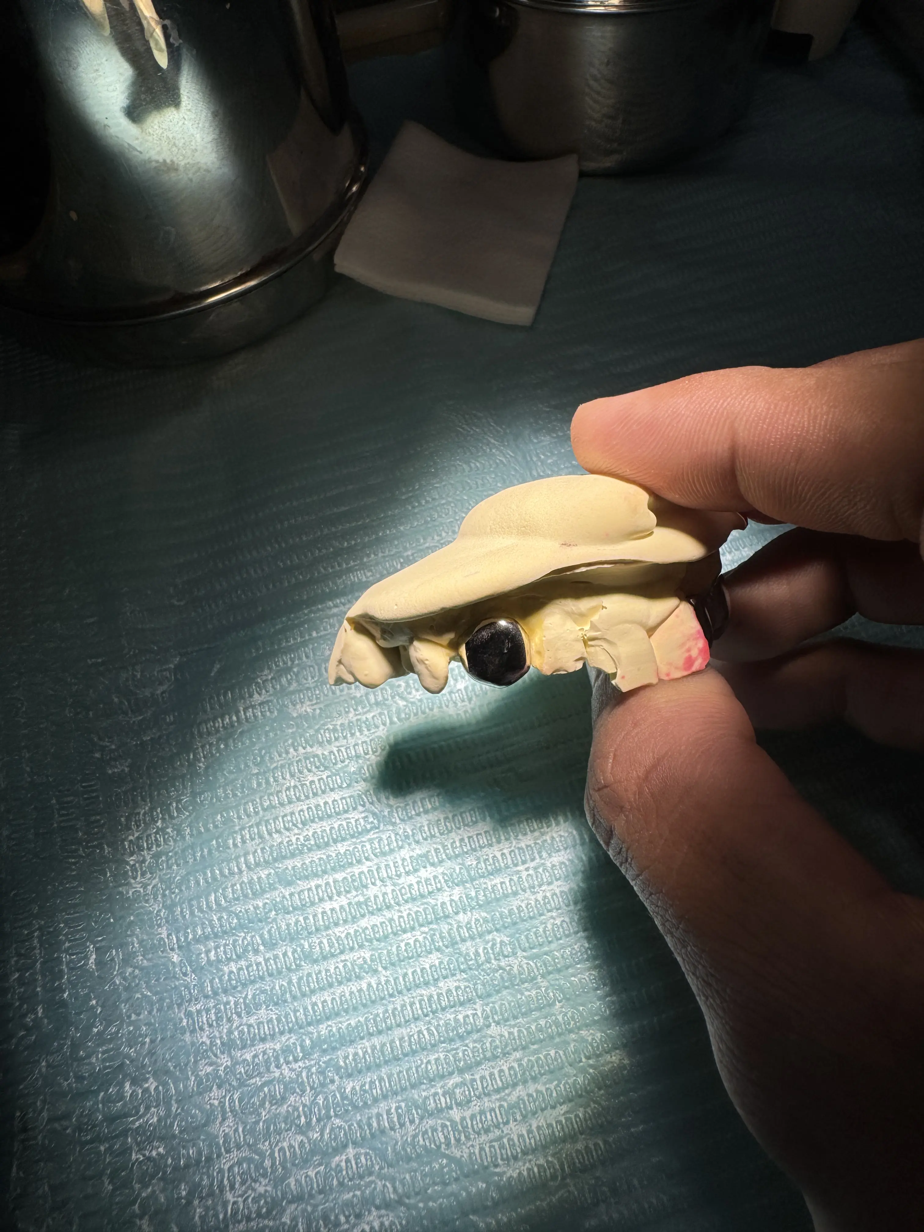 Detailed view of Full single grillz Dental Jewelry