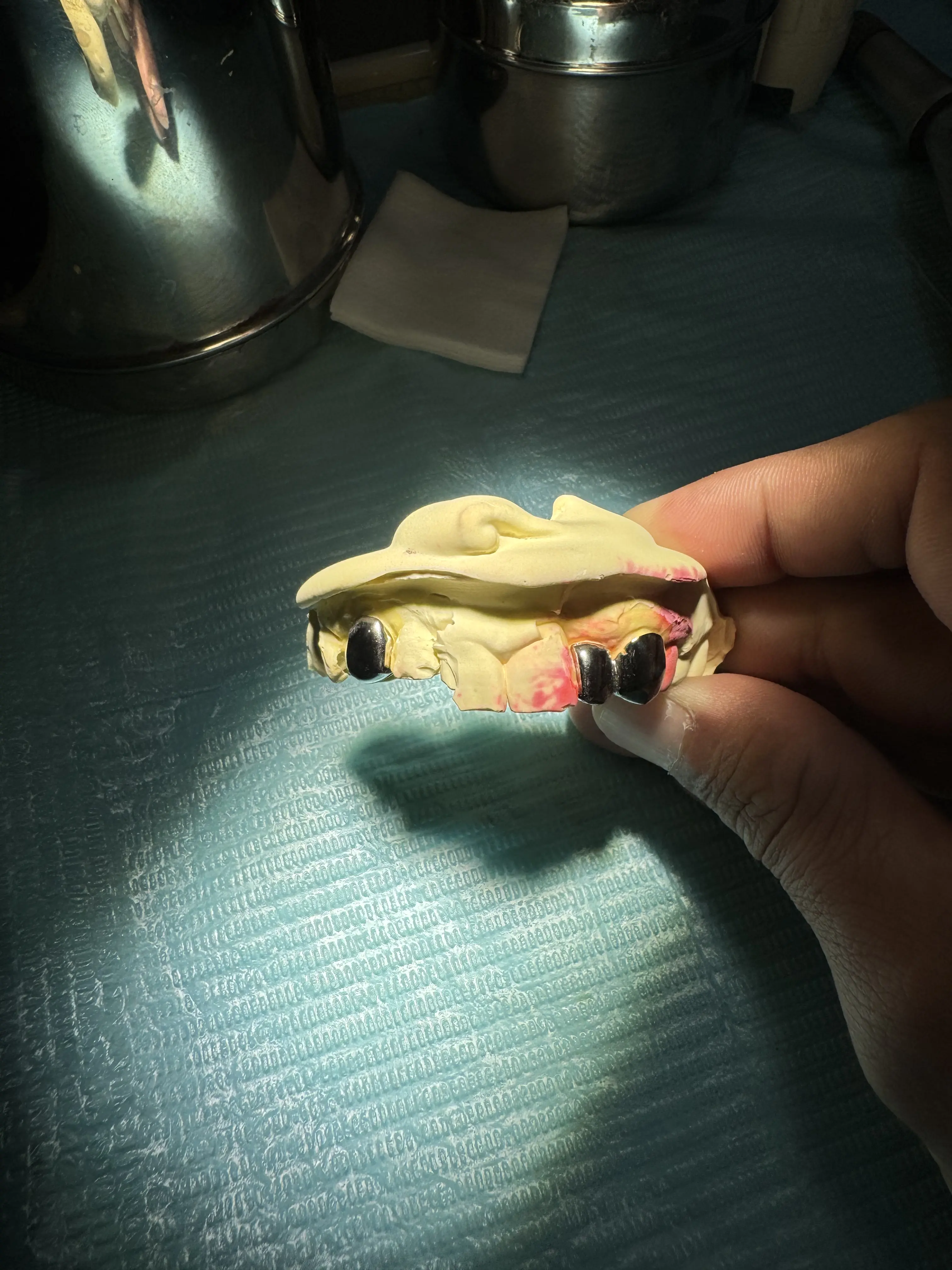 Full single grillz Custom Collection in Phnom Penh Cambodia