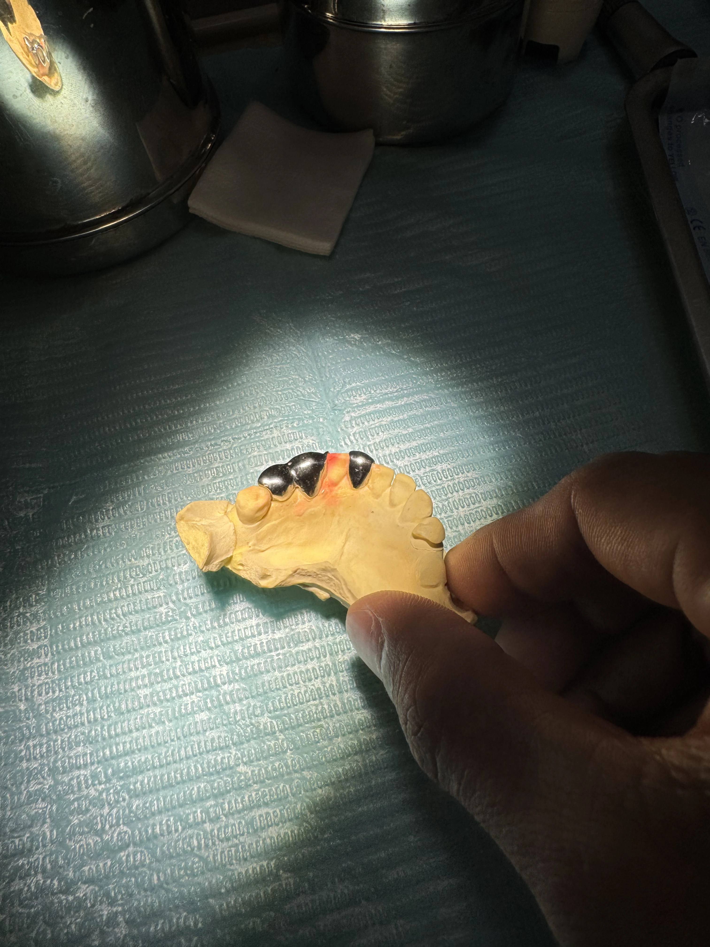 Detailed look at Costume Line Grillz on button Dental Jewelry