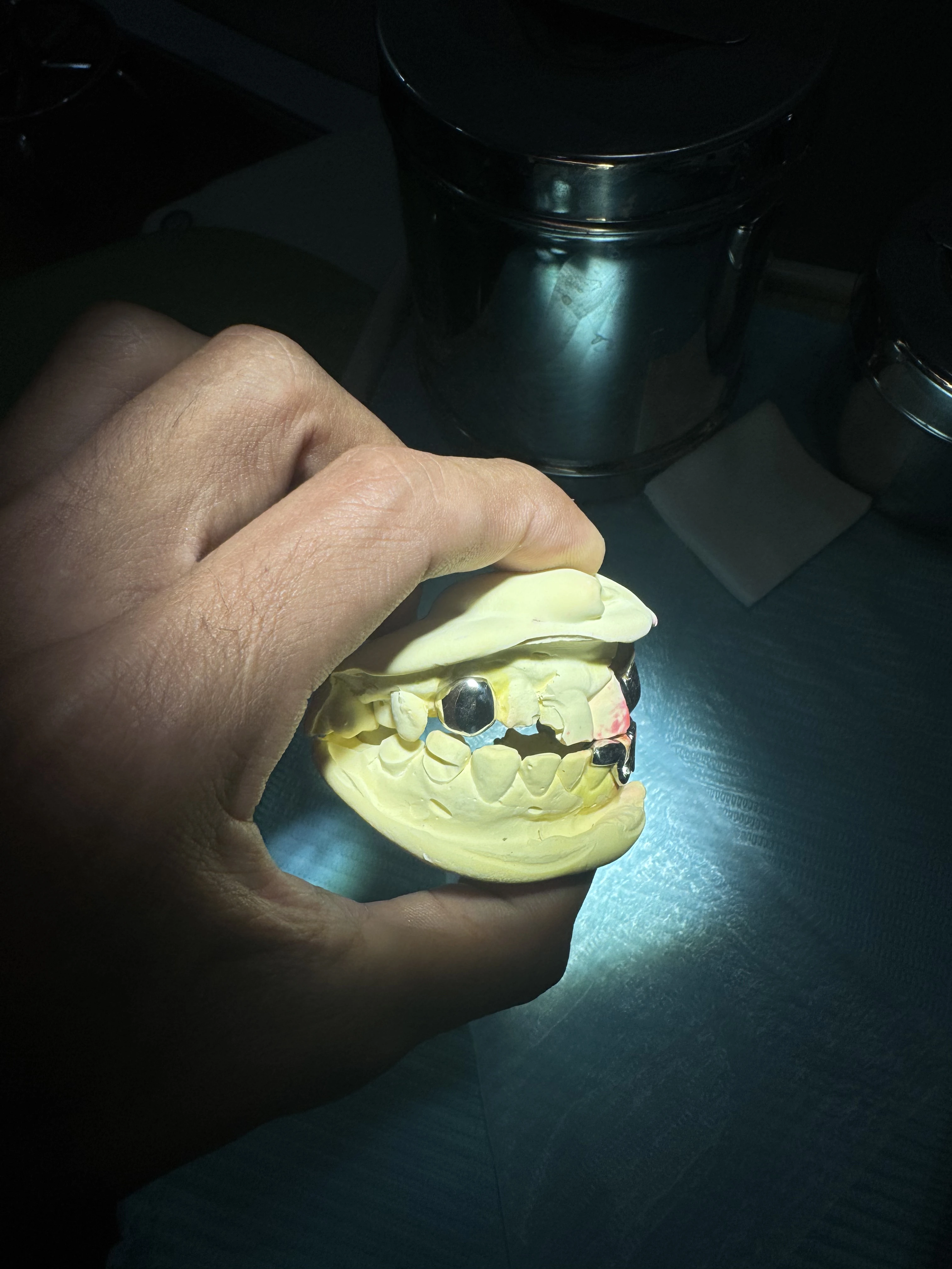 Detailed look at Full couple grillz Dental Jewelry