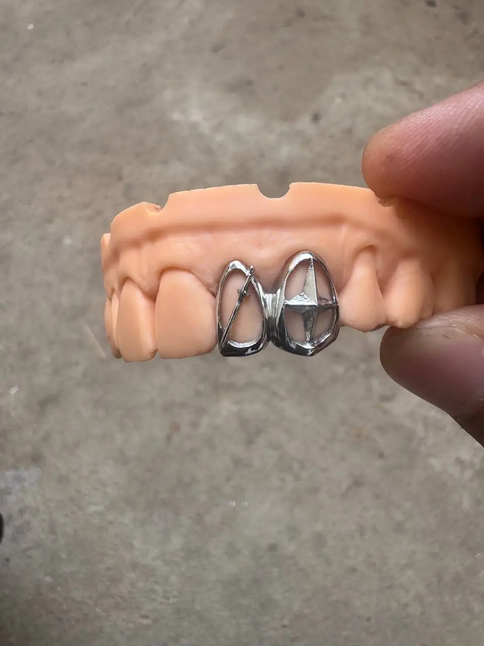 Custom star x sword Grillz in Phnom Penh Cambodia