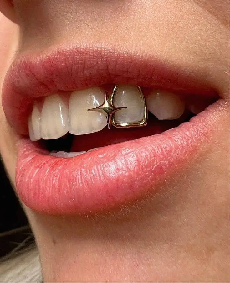 Window star Grillz in Phnom Penh Cambodia