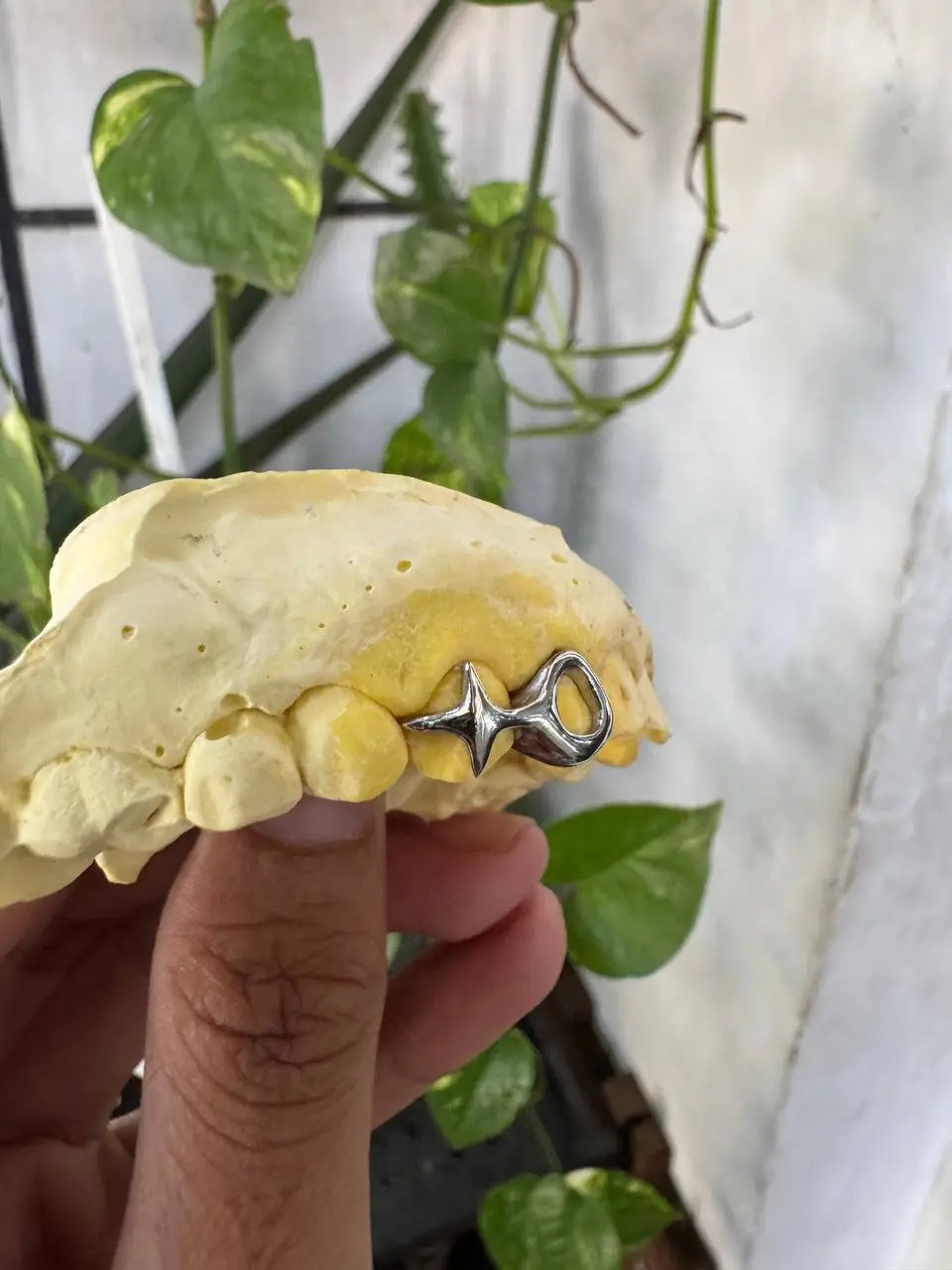 Window and star Grillz in Phnom Penh Cambodia