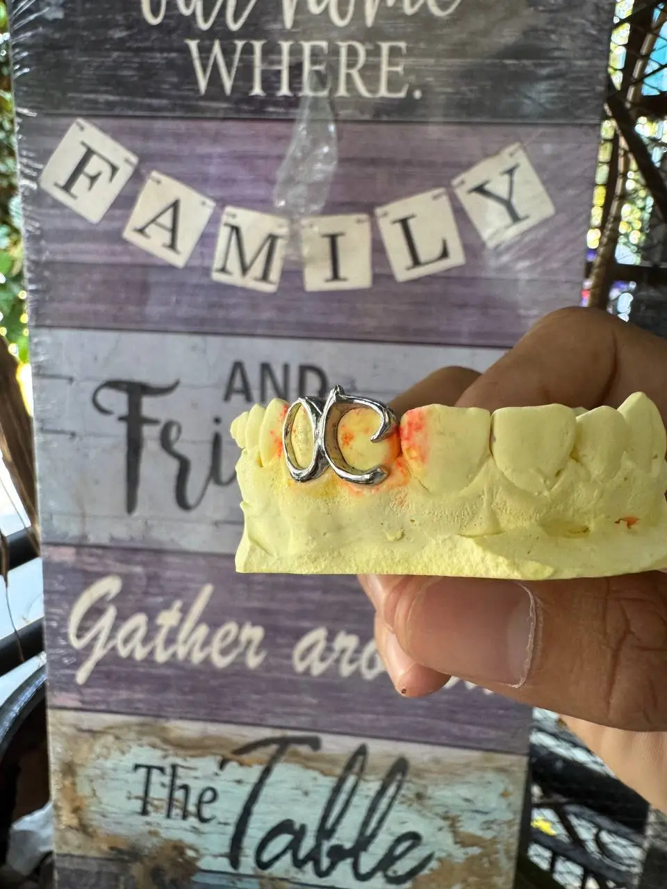 Detailed look at Window and custom style dental jewelry